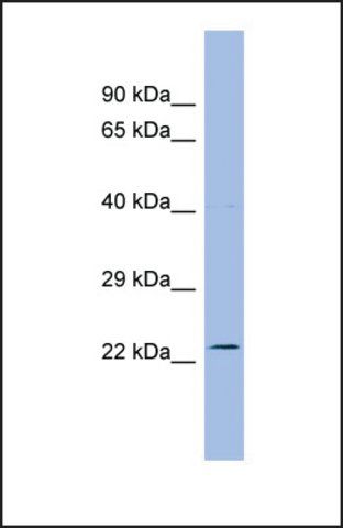 Anti-AK3L1, (N-terminal) antibody produced in rabbit