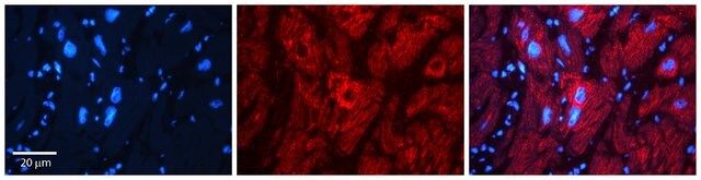 Anti-AK1 (ab1) antibody produced in rabbit