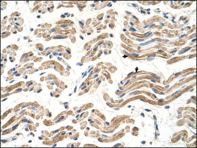 Anti-ALDH4A1 (AB2) antibody produced in rabbit