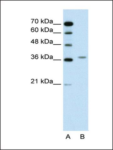 Anti-ALAD (AB1) antibody produced in rabbit