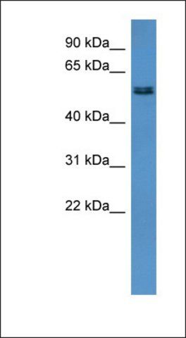 Anti-ALG8 antibody produced in rabbit