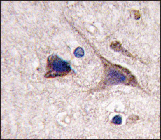 Anti-ALDH5A1 (C-term) antibody produced in rabbit