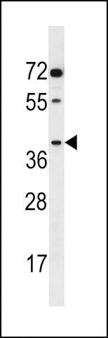 ANTI-AKR1E2(C-TERMINAL) antibody produced in rabbit