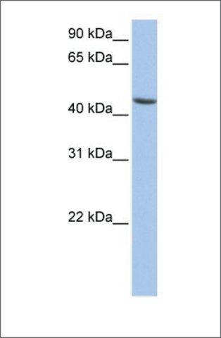 Anti-ALDH3B1 antibody produced in rabbit