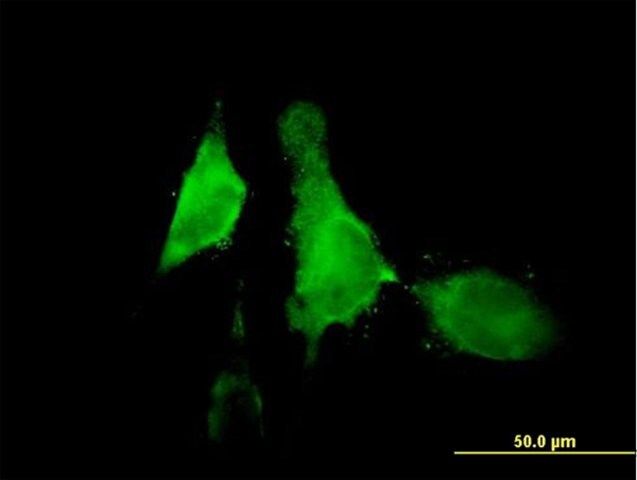 Anti-ALOX12 antibody produced in mouse