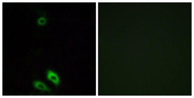 Anti-AKR1CL1 antibody produced in rabbit