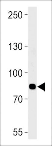 Anti-AMPD3 (center) antibody produced in rabbit