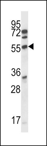 ANTI-ALS2CR7(N-TERMINAL) antibody produced in rabbit