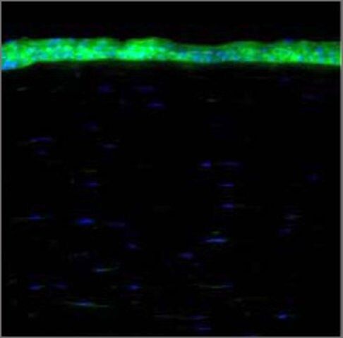 Anti-ALDH1A1 antibody produced in rabbit