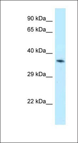 Anti-ALAD antibody produced in rabbit