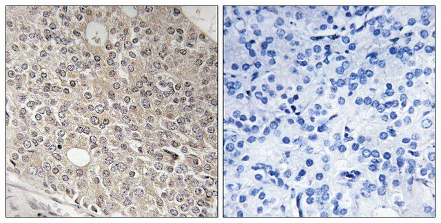 Anti-AMOTL1 antibody produced in rabbit