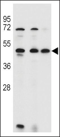 ANTI-ANKRD40(C-TERMINAL) antibody produced in rabbit