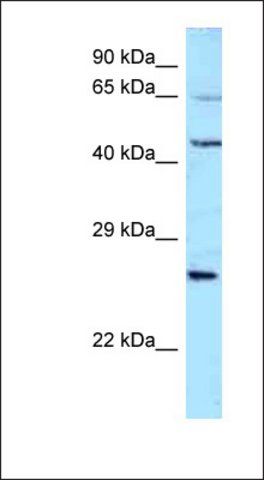 Anti-ALS2CR11 antibody produced in rabbit