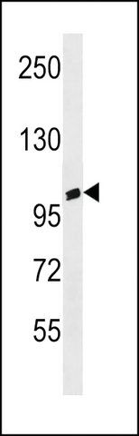 ANTI-ANKRD20A3(C-TERMINAL) antibody produced in rabbit