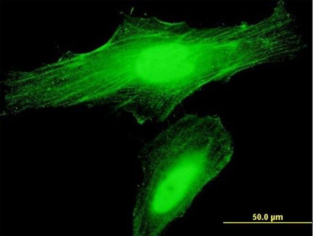 Anti-ANLN antibody produced in mouse