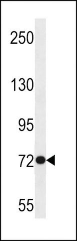 ANTI-ANKRD56 (CENTER) antibody produced in rabbit