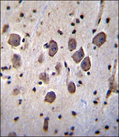 ANTI-ANKRD34C (C-TERM) antibody produced in rabbit