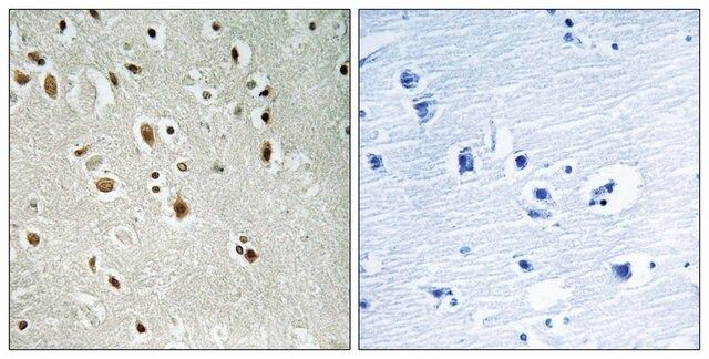 Anti-ANKRD20A3 antibody produced in rabbit