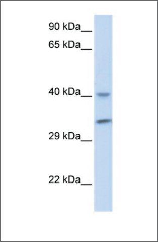 Anti-ALKBH3 antibody produced in rabbit