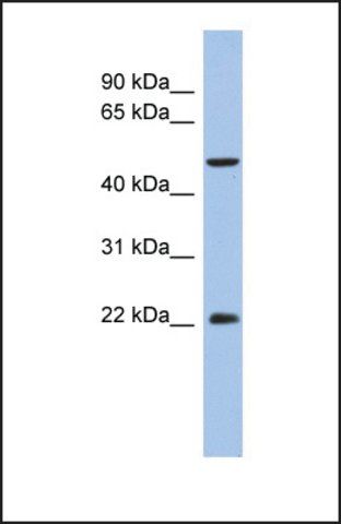 Anti-ANKH, (N-terminal) antibody produced in rabbit