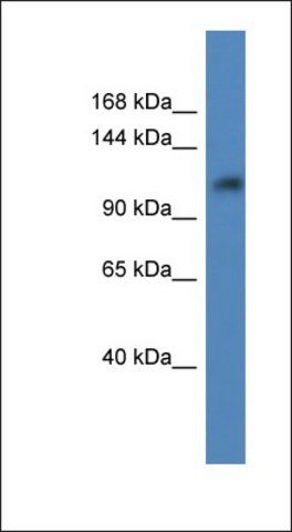 Anti-ANKRD27 antibody produced in rabbit