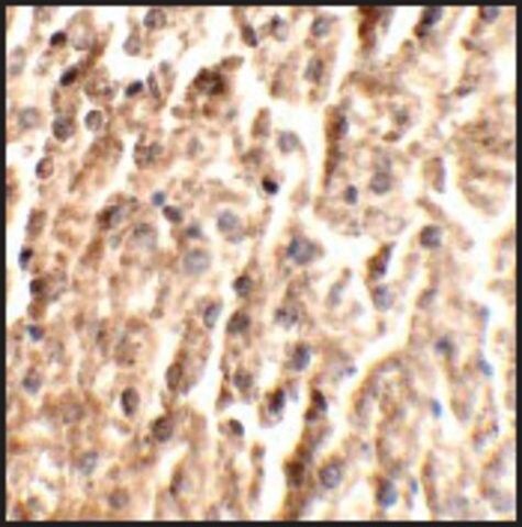 Anti-ANGPT2 antibody produced in rabbit