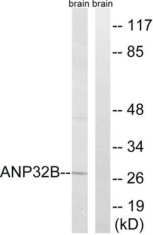 Anti-ANP32B antibody produced in rabbit