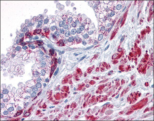 Anti-ANKRD54 antibody produced in rabbit