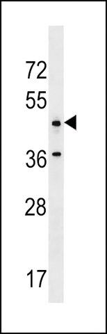 ANTI-ANKRD61(C-TERMINAL) antibody produced in rabbit