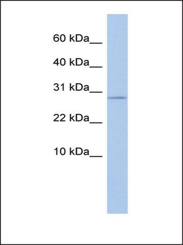 Anti-ANKRD7 (AB1) antibody produced in rabbit