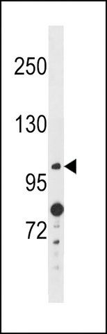 ANTI-ANO4(N-TERMINAL) antibody produced in rabbit