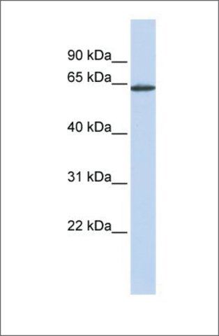 Anti-ANTXR1 antibody produced in rabbit