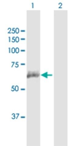 Anti-ANTXR2 antibody produced in mouse