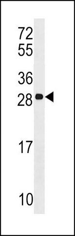 ANTI-ANP32C (CENTER) antibody produced in rabbit