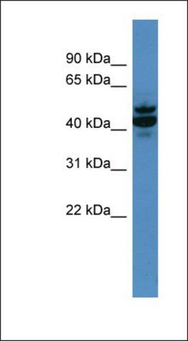 Anti-ANTXR2 antibody produced in rabbit