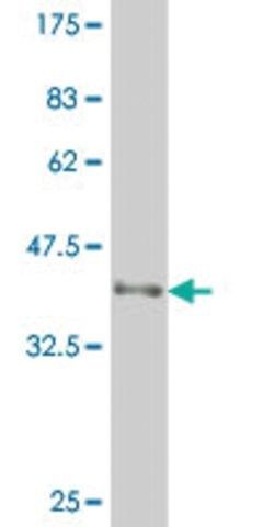 ANTI-ATOH1 antibody produced in mouse