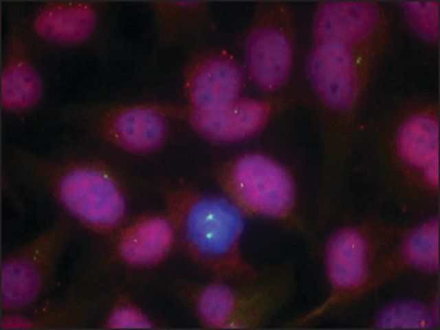 Anti-ATM (Ab-1981) antibody produced in rabbit