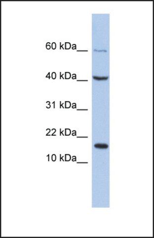 Anti-ATOH7 antibody produced in rabbit