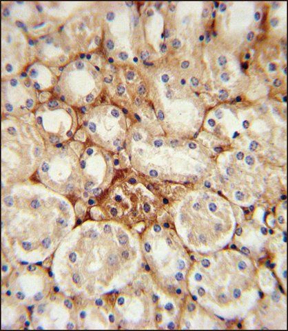 ANTI-ATP5J2 (CENTER) antibody produced in rabbit