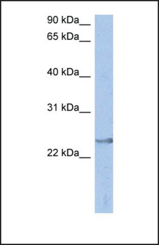 Anti-ATP6V1E2 antibody produced in rabbit