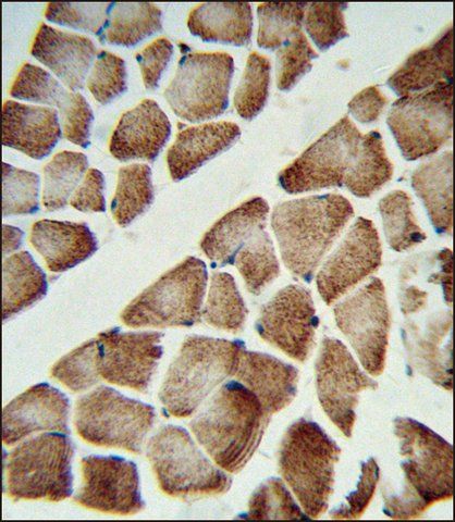 ANTI-ATP5C1 (N-TERM) antibody produced in rabbit