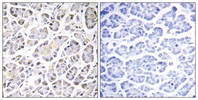 Anti-ATP5G3 antibody produced in rabbit