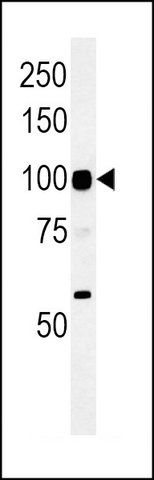 ANTI-ATP6V0A4 (CENTER) antibody produced in rabbit