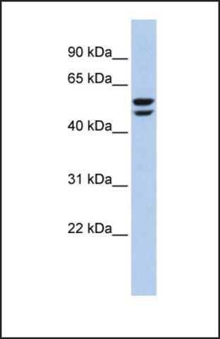 Anti-ATP6V1B2, (N-terminal) antibody produced in rabbit