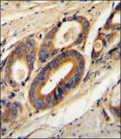 ANTI-ATP6V0B (CENTER) antibody produced in rabbit