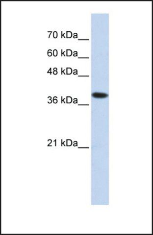 Anti-ATP4B antibody produced in rabbit