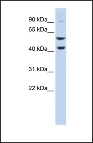 Anti-ATP6V1B2 antibody produced in rabbit