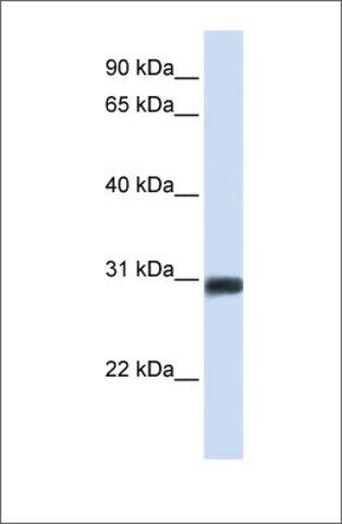 Anti-BARX2 antibody produced in rabbit