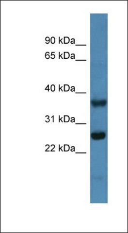 Anti-ATP5F1 antibody produced in rabbit