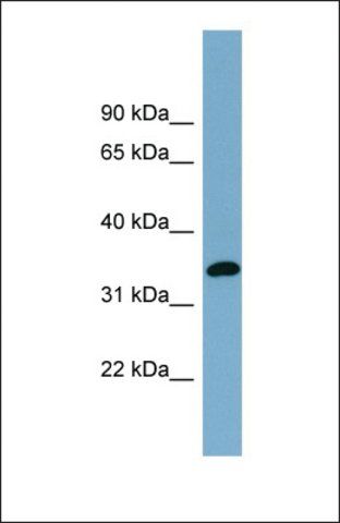 Anti-AWAT1, (N-terminal) antibody produced in rabbit